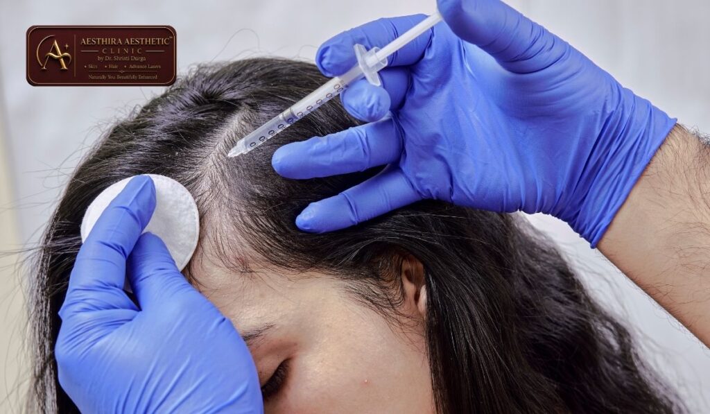Hair Loss Treatment with PRP in Indirapuram