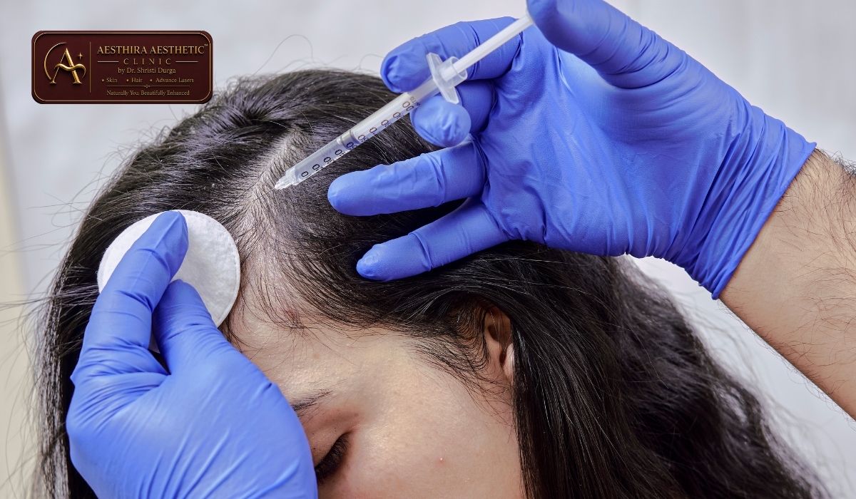 Hair Loss Treatment with PRP in Indirapuram