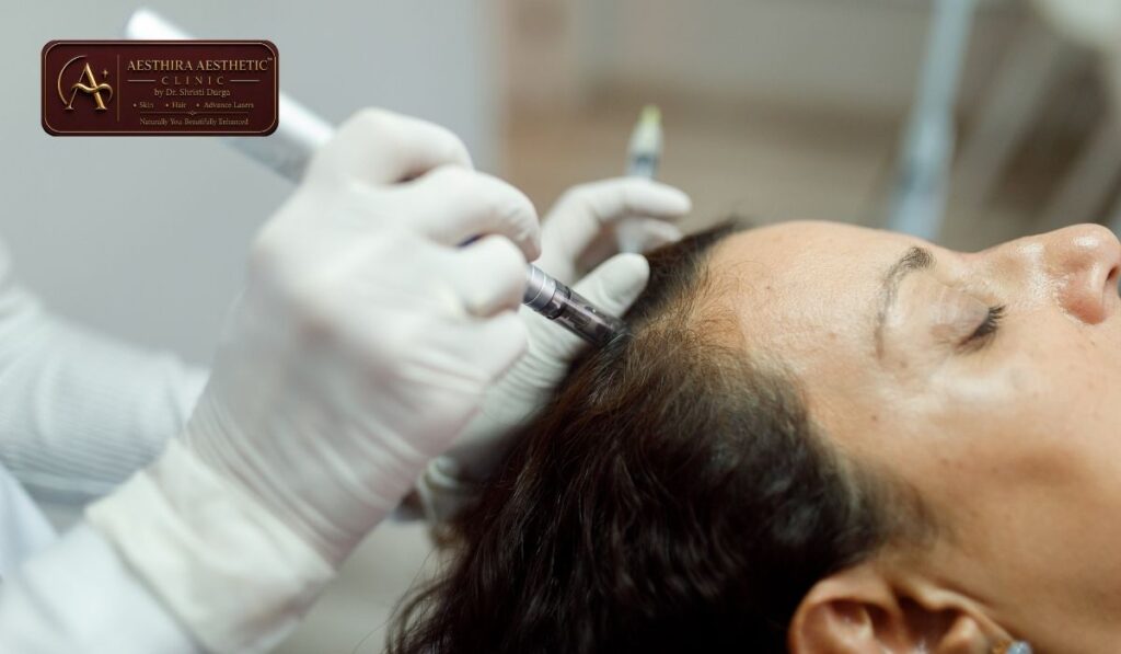 PRP Hair Treatment in Indirapuram – Everything You Need to Know
