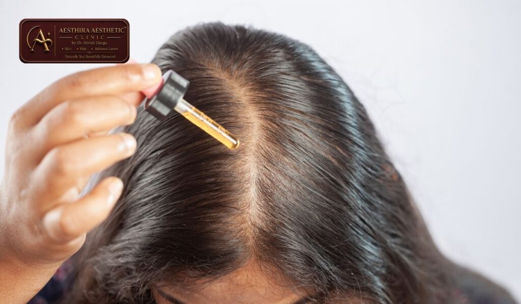 Diagram showing how PRP concentrates growth factors to stimulate hair follicles

