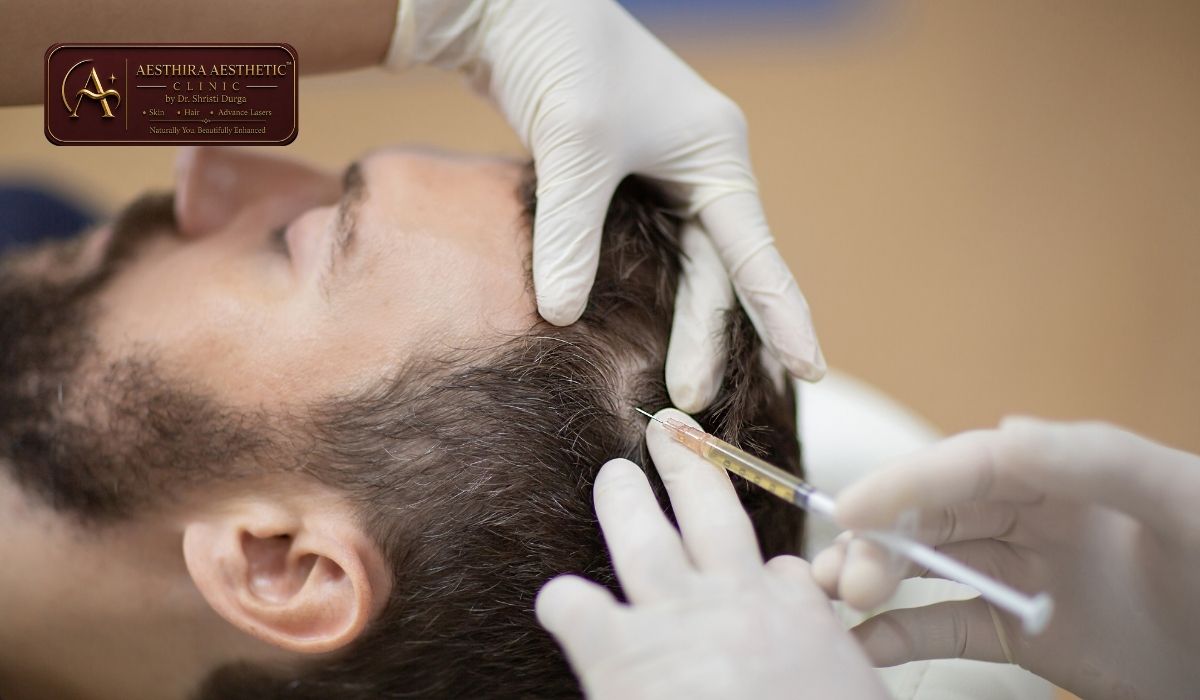 Microneedling vs PRP for Hair Growth in Indirapuram
