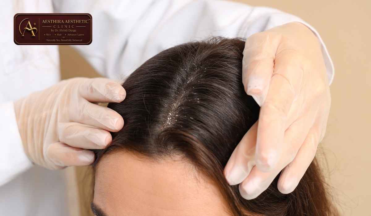 Hair & Scalp Analysis in Indirapuram: What Does It Tell You?